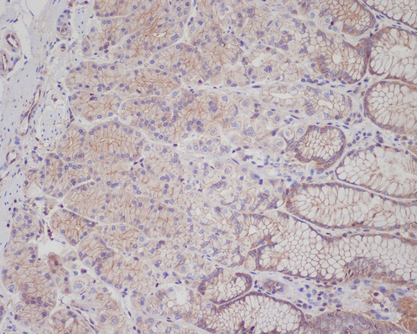 IHC - Anti-Met (c-Met) Rabbit Monoclonal Antibody ABO14067